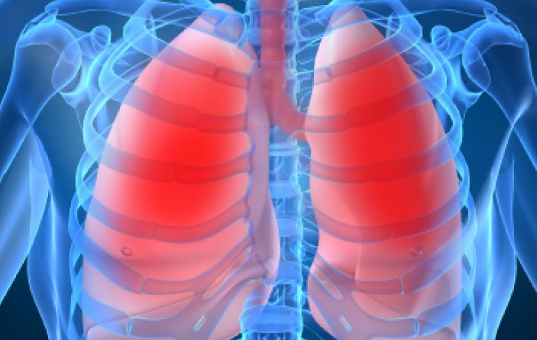 Theragenomic medicine: Orkambi approved by the FDA as a new treatment for cystic fibrosis