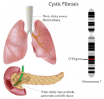 Cystic Fibrosis I