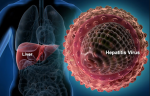 Elbasvir/Grazoprevir (Zepatier) for the treatment of chronic hepatitis C virus (HCV) genotypes 1 and 4 infections