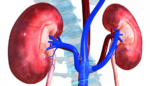 Sodium-glucose cotransporter-2 (SGLT2) inhibitors in Type-2 Diabetes: Risk of acute kidney injury