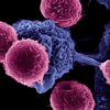 Cancer therapies: Immune checkpoint inhibitors may kill you