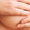 Is there breast implant-associated cancer (BIA-ALCL)?