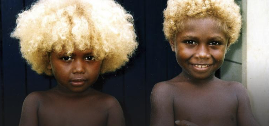 Individuen dunkler Hautfarbe mit natürlichen blonden Haaren – In der Genetik ist alles möglich