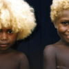Les individus de peau foncée aux cheveux blonds naturels - En génétique, tout est possible