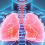 Three idiopathic pulmonary fibrosis (IPF)-associated genes newly identified