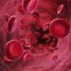 Gene therapy: Hope for patients with beta-thalassemia?